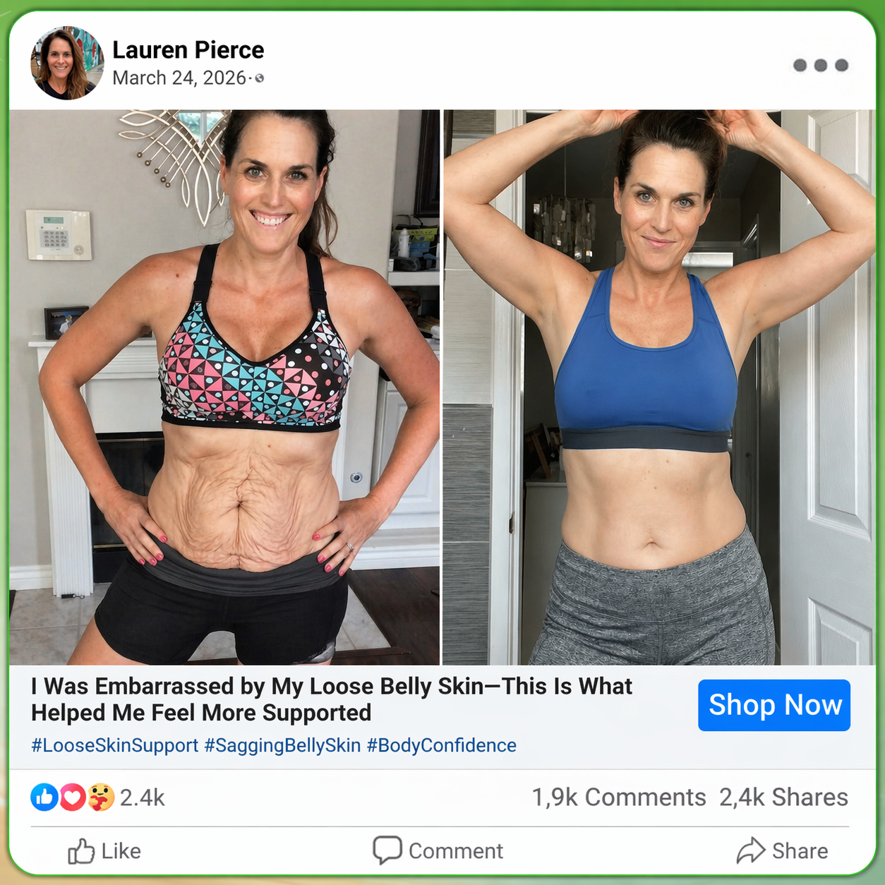 𝑶𝒇𝒇𝒊𝒄𝒊𝒂𝒍 𝑺𝒕𝒐𝒓𝒆  |🇺🇸🇺🇸𝐂𝐚𝐫𝐞𝐔𝐩𝐥𝐢𝐟𝐭® 𝑴𝒆𝒕𝒂𝒃𝒐𝒍𝒊𝒄 𝑵𝒂𝒏𝒐 𝑴𝒊𝒄𝒓𝒐𝒏𝒆𝒆𝒅𝒍𝒆 𝑷𝒂𝒕𝒄𝒉🇺🇸(𝐉𝐮𝐬𝐭 𝐨𝐧𝐜𝐞 𝐚 𝐝𝐚𝐲, 𝐯𝐢𝐬𝐢𝐛𝐥𝐞 𝐜𝐡𝐚𝐧𝐠𝐞𝐬 𝐢𝐧 𝟕 𝐝𝐚𝐲𝐬）𝘽𝙚𝙧𝙗𝙚𝙧𝙞𝙣𝙚 + 𝙈𝙤𝙧𝙞𝙣𝙜𝙖 𝙁𝙤𝙧𝙢𝙪𝙡𝙖 ✅ 𝐅𝐨𝐫 𝐨𝐛𝐞𝐬𝐢𝐭𝐲, 𝗟𝗼𝗼𝘀𝗲 𝘀𝗸𝗶𝗻,𝐝𝐢𝐚𝐛𝐞𝐭𝐞𝐬, 𝐬𝐥𝐞𝐞𝐩 𝐚𝐩𝐧𝐞𝐚, 𝐣𝐨𝐢𝐧𝐭 𝐢𝐬𝐬𝐮𝐞𝐬, 𝐚𝐧𝐝 𝐦𝐨𝐫𝐞 💯💯